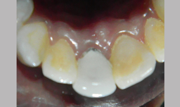 cosmetic dentistry treatment in Anand                    